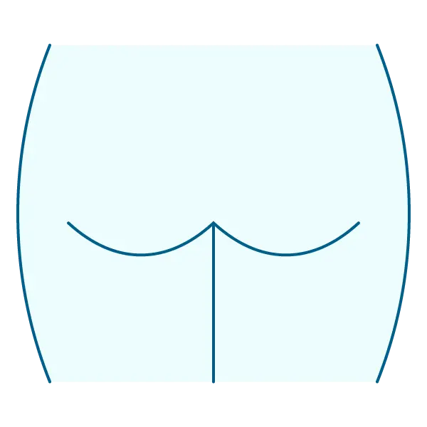 Лечение последствий анального секса